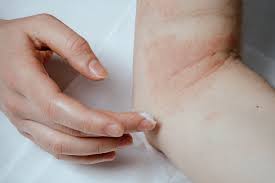 Dermatologia si bolile venerice